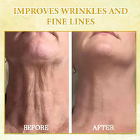 ALLILUYAA 2PCS Fubsta SkinFirming Rejuvenating Oil, Fubsta Skin Firming Rejuvenating Oil, Fubsta Firming Oil, Fubsta Skin Firming Oil, Fubsta Skin Firming Serum for Body, Deep Nourishing, Reduce Fine Lines
