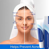 ISBEAUSOLS Retinol Cream Face Moisturiser-Face Cream For Women-Night Cream For Women Anti Aging-Skincare with Retinol and Vitamin A-Face Care for Smooths,Firming and Long Lasting Hydrating
