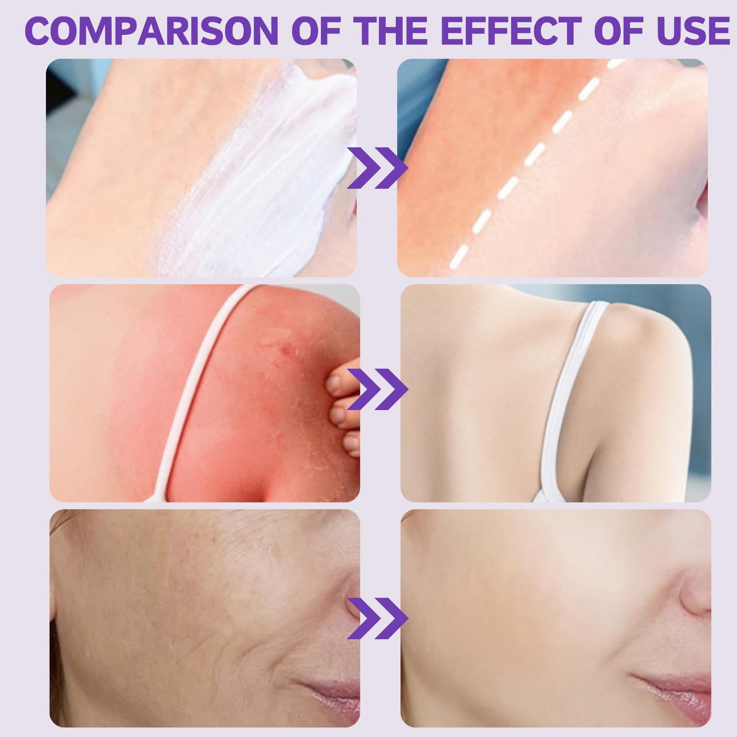 ISBEAUSOLS Sunscreen Spf 100 - Face Sunscreen Factor 100 - Face & Body Sunblock Moisturizer Spf100++ - High Protection Against Uva & Uvb For Women,Men - Restores, Soothes, Protects Weakened Skin Cream
