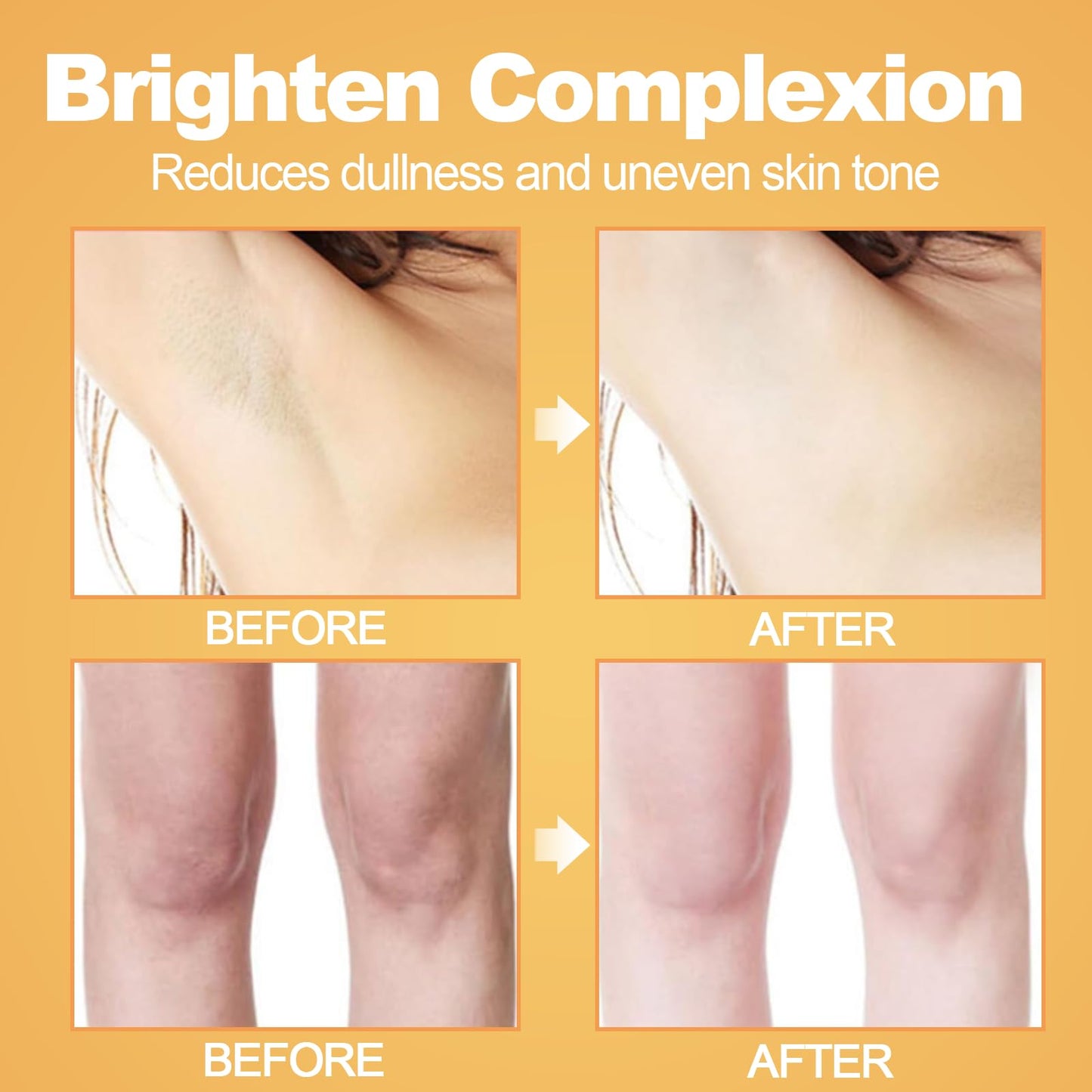 Kojic Acid Underarm Cream, Dark Underarms Treatment Skin Lightening Cream for Dark Knees & Elbows, with Alpha Arbutin & Niacinamide, Brightens, Smooths & Evens Skin Tone, Non-Greasy Formula, 50ml
