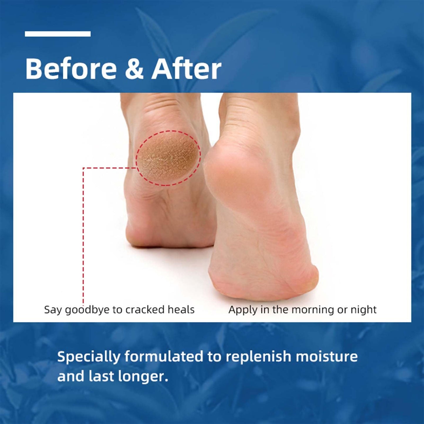 NLFOX Urea Foot Cream - Urea Cream for Cracked Heels and Dry Skin - Urea Cream 40% for Feet - Deep Moisturizing Foot Cream Treatment Maximum Strength Urea cream for Callused Rough Skin