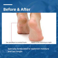 NLFOX Urea Foot Cream - Urea Cream for Cracked Heels and Dry Skin - Urea Cream 40% for Feet - Deep Moisturizing Foot Cream Treatment Maximum Strength Urea cream for Callused Rough Skin