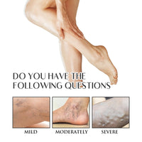 Oumun Care Cream for Legs,Vari/cose Ve/ins Cream,Improve Blood Circulation,Vari/cose Ve/ins Treatment for Legs,Strawberry Skin Treatment,Urea Cre/am Kerat/osis Pila/ris,Cre/am for Dry Skin on Le/gs