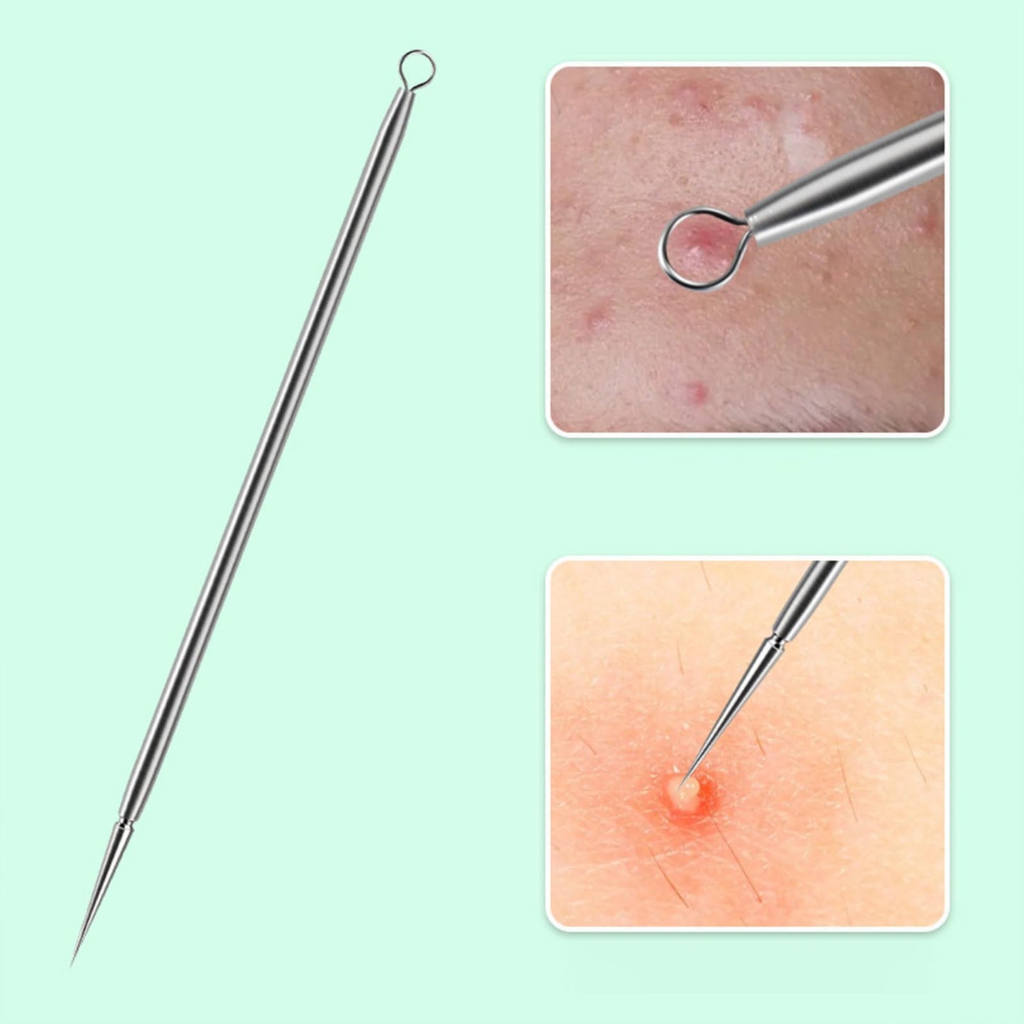 Titanium Lancet Needle Acne Blackhead Remover Pimple Extractor Popper Tool,spot Popper,spot Picker Tool