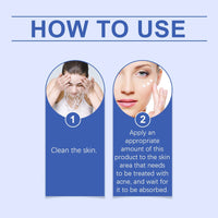 Anti Acne Face Cream,Anti A/cne Removal C/ream,Ac/ne Scar Removal Cr/eam,Dark Spot Cream,Facial Acn/e Treatment Gel,Daily Facial Moisturizer for A/cne Prone Skin,Acne Spot Treatment,Gentle Acne Cream