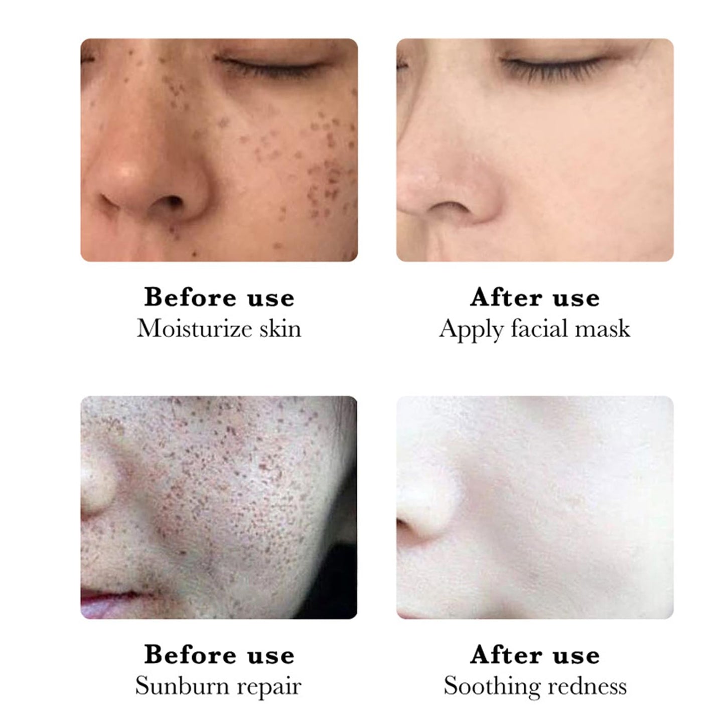 Pack of 2 Whitening Freckle Cream, Anti-Hyperpigmentation Skin Brightening Cream, Anti-Freckle Niacinamide Cream, Face Cream Against Dark Spots, Pigment Spots, Remover Face