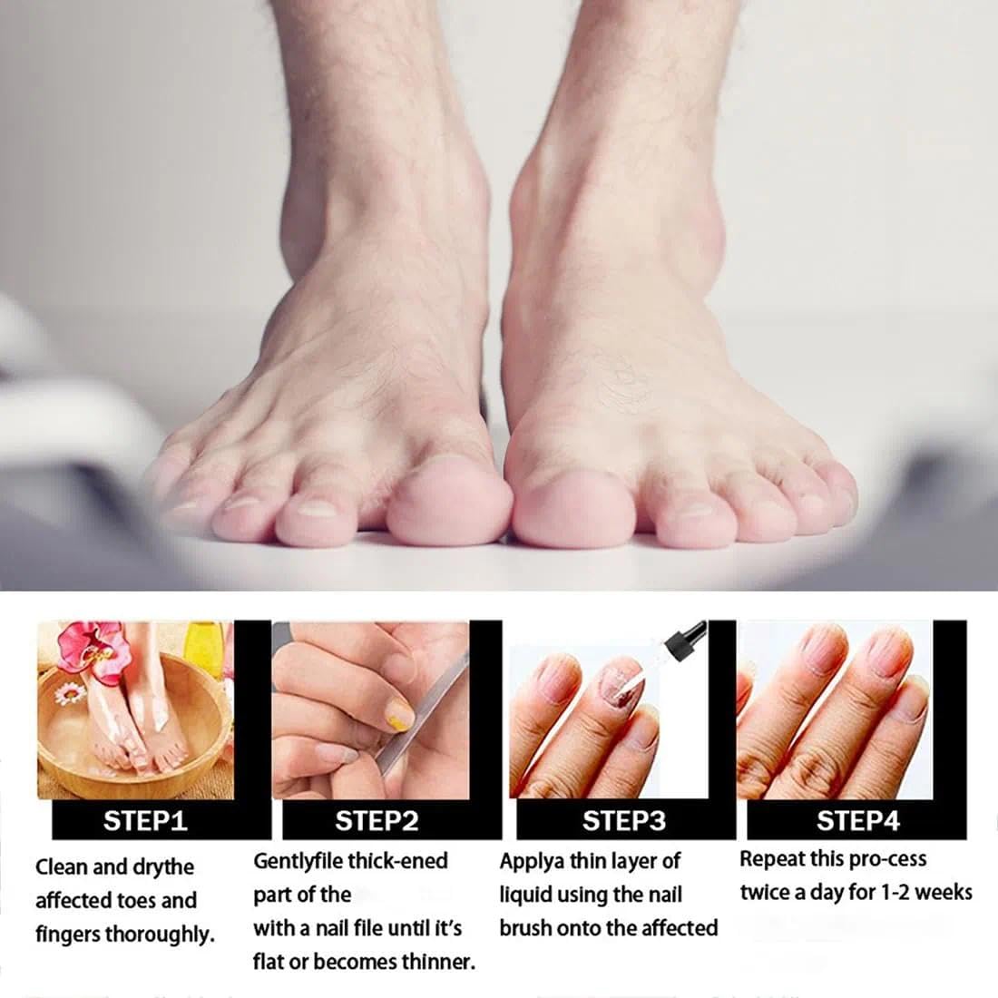 Ginger Nail Essence, 7days Nail Treatment,Hand Oil Damaged Nail Repair And Strengthening Nail Care 3PCS