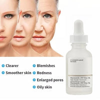 MIZEEYE Niacinamide Serum for Face, 2PCS Moisture Niacinamide Face Serum for Women, Niacinamide 10% + Zinc 1% Serum For Acne, Refreshing.