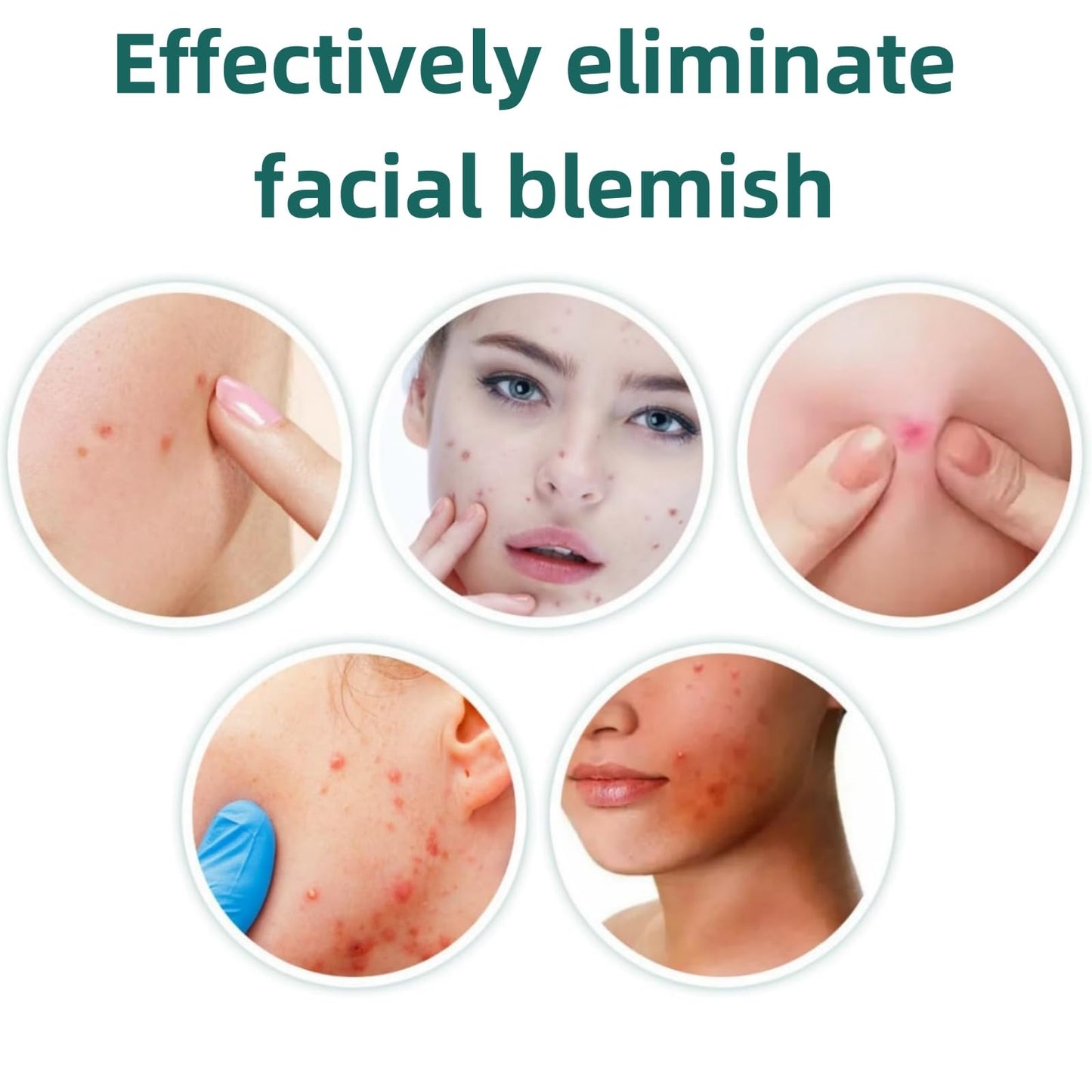 Yoowan Freckle Removal Cream,Skin Barrier Repair Cream,Oil Free Moisturiser,Anti Wrinkle Balm Instantly Lifts/Tightens/Resists Aging/Lightens Fine Lines,Deep Facial Moisturizing,Soothing,Relieve Swelling