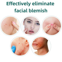 Yoowan Freckle Removal Cream,Skin Barrier Repair Cream,Oil Free Moisturiser,Anti Wrinkle Balm Instantly Lifts/Tightens/Resists Aging/Lightens Fine Lines,Deep Facial Moisturizing,Soothing,Relieve Swelling