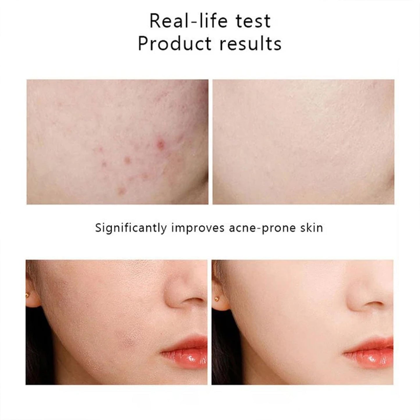 MIZEEYE Niacinamide Serum for Face, 2PCS Moisture Niacinamide Face Serum for Women, Niacinamide 10% + Zinc 1% Serum For Acne, Refreshing.
