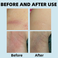 Fankayi Anti-Chafe Stick,Waterproof Anti Chafe Stick,Glide Anti Chafing Stick,Thigh Anti Chafe Stick,Running Chafe Stick,Body Anti-Chafe Balm for Heel,Lower Arm,Legs,Skin Protection,glide anti chafing stick