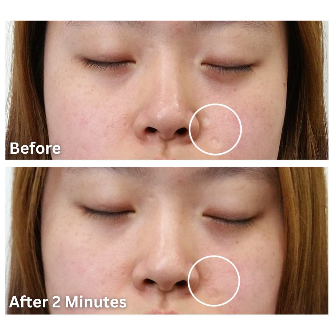 Dermaflage Cover Up - Concealer for Scars, Frown Lines from Hollywood Pro