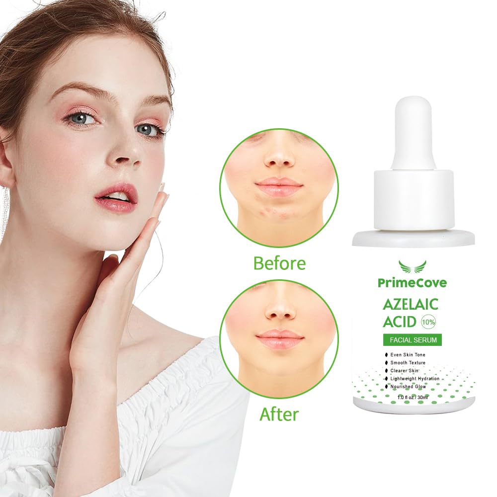'PrimeCove - 10% AA Serum (30ml) | Skin Brightening, Even Skin Tone, Texture Refinement, Acne Management, Reduced Redness, Hydration, Natural Radiance, Anti-Aging & Minimised Pores