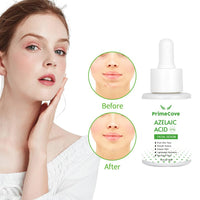 'PrimeCove - 10% AA Serum (30ml) | Skin Brightening, Even Skin Tone, Texture Refinement, Acne Management, Reduced Redness, Hydration, Natural Radiance, Anti-Aging & Minimised Pores