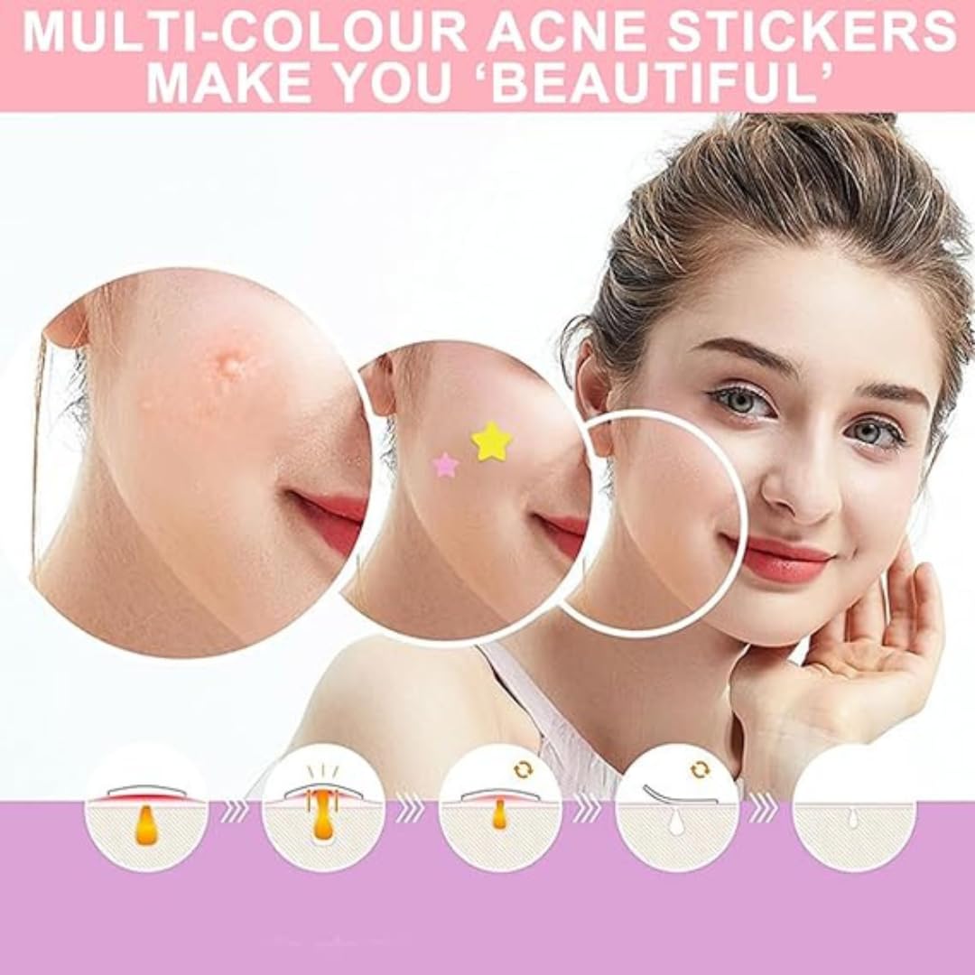 Generic Blue Star Pimple Patches for Face, Hydrocolloid Patches, Patch to Cover Zit & Blemishes, Spot Stickers, Blue Spot Patches, Breakout-Fighting Dots (standard, 40, count) Multiple sizes