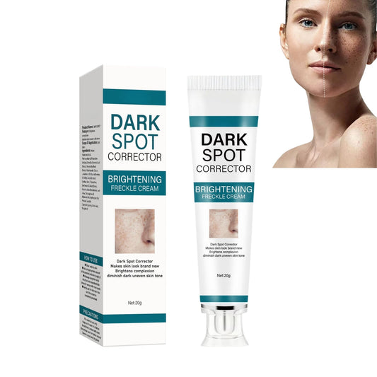 SHEBEEDO Dark Spot Removal Cream for Women, Freckle Removal Cream for Sun Spots, Freckles, Hyperpigmentation, Dark Spot Corrector - Nourishing Skin Care for All Skin Types, Fades Spots Gradually