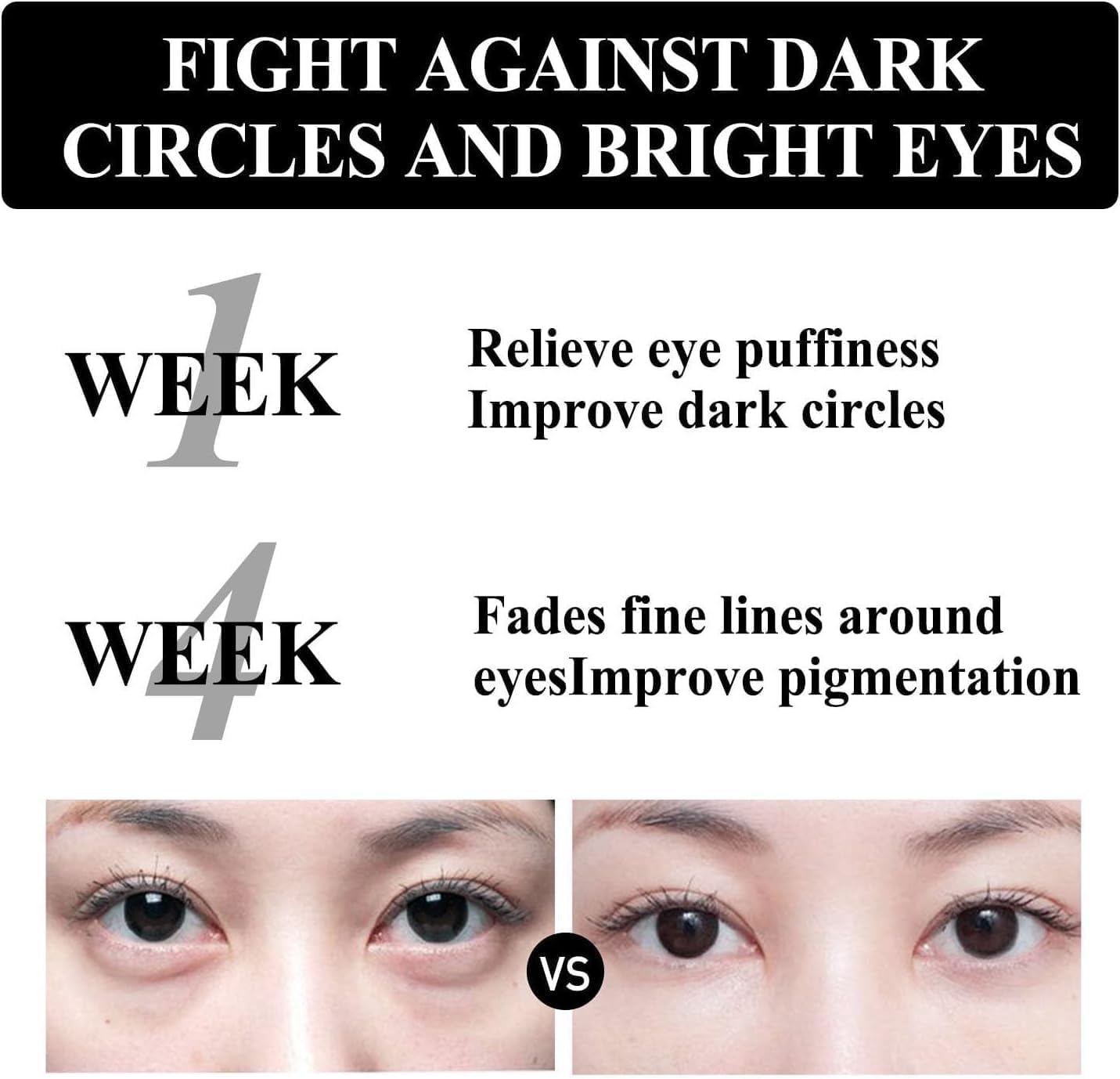 ALLILUYAA Berbax Eye Cream, 2pcs Berbax Instant Firmx Eye Tightener,Eye Firming Cream Tightening Lifting Sagging Skin for Puffiness And Bags Under Eyes