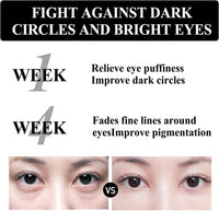 ALLILUYAA Berbax Eye Cream, 2pcs Berbax Instant Firmx Eye Tightener,Eye Firming Cream Tightening Lifting Sagging Skin for Puffiness And Bags Under Eyes