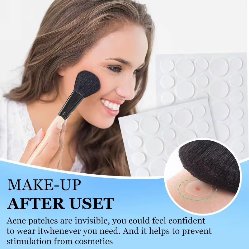Generic Pimple patch