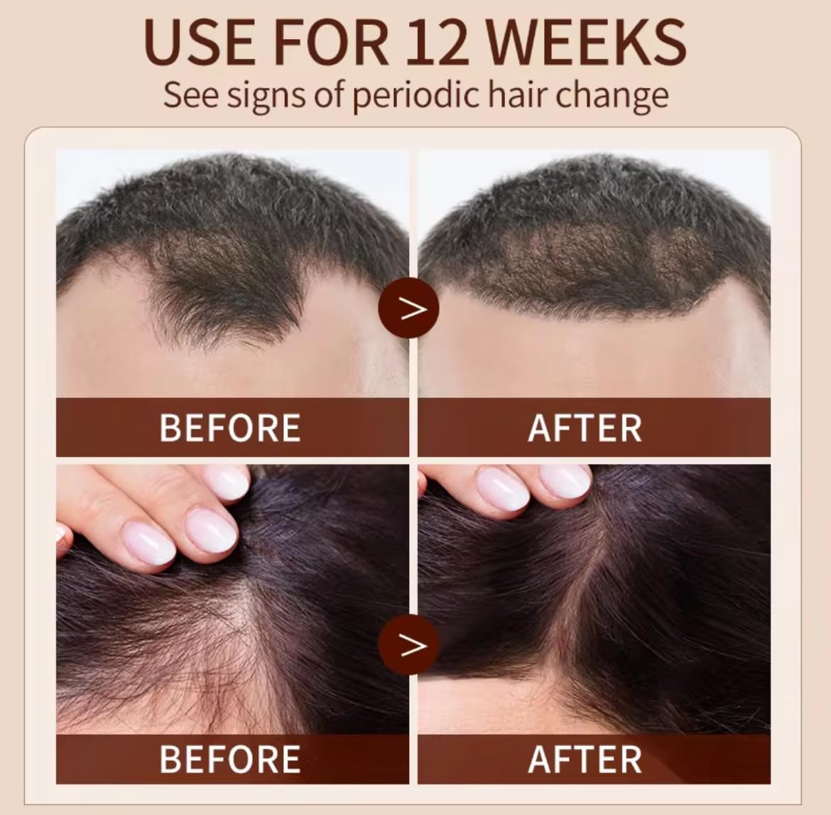 Generic Hair Growth Elixir, Natural Herbal Oil Serum, 50ml, for Hair Loss Treatment and Scalp Care