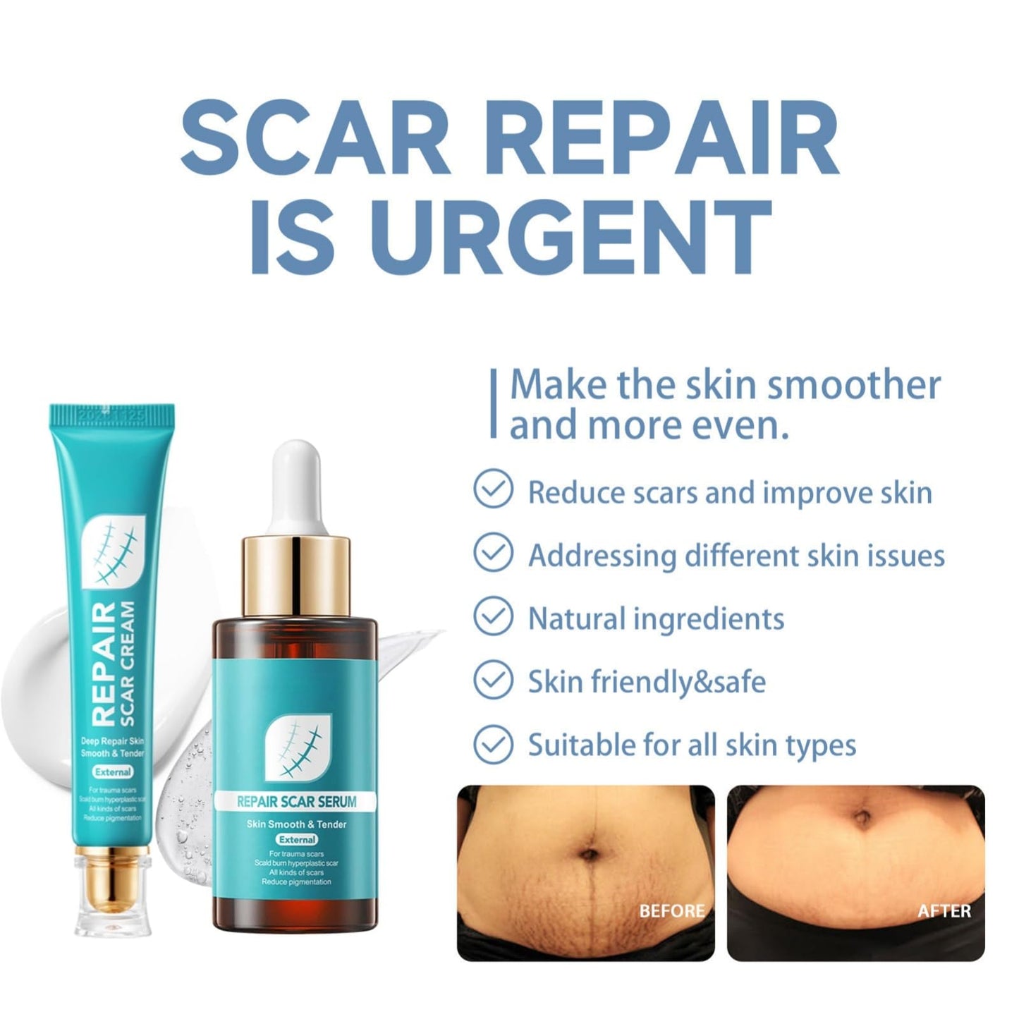 Jinjiar Scar Removal Set with Repair Scar Cream & Serum,Scar Removal Cream,Scar Treatment,Advanced Scar Gel for Old and New Scars,Scar Crea-m After Surgery,S-car Healing Cre-am,Acne Sc-ar Treatment,Scar Away