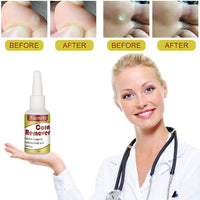 Corn Remover Wart Remover Corn Removal Corn Remover for Feet, Callus Remover, Cuticle Remover, Corn Remover Liquid to against Corn & Wart,15ml