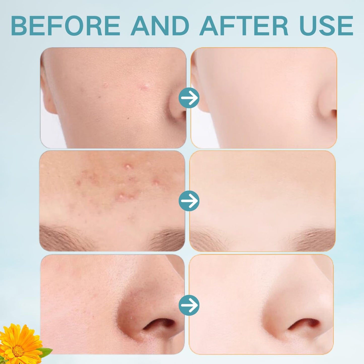 Glycolic Acid Pads - Cleansing Pads - Face Wipes With Vitamins B5, C & E - Face Exfoliator Pad Face Pads Toner Pads - Exfoliating Pads for Skin Repair Treat Acne Reduce Blackheads 50pcs