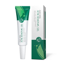 Acne Spot Treatment Cream, Aloe Vera Acne Removal Gel, Spot Cream Targets Acne, Pimples, Blemishes and Blackhead Removal, Acne Cream Anti-Acne, Oil-control, Remove pimples, Shrink Pores