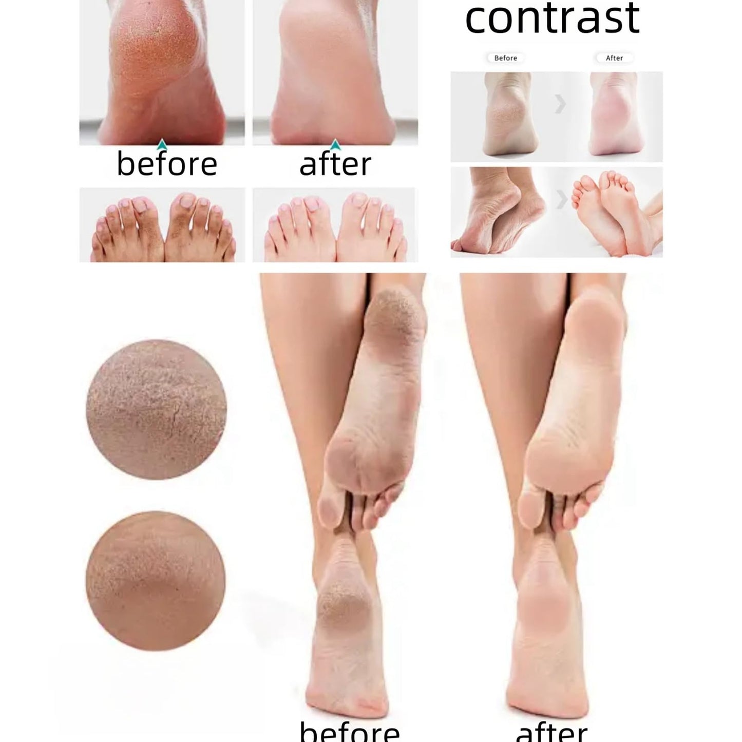Tea Tree Oil Foot Cream for Cracked Heels & Dry Skin – Intensive Moisturizing Formula, Callus Softens for Hard Skin, Softens Feet & Hands