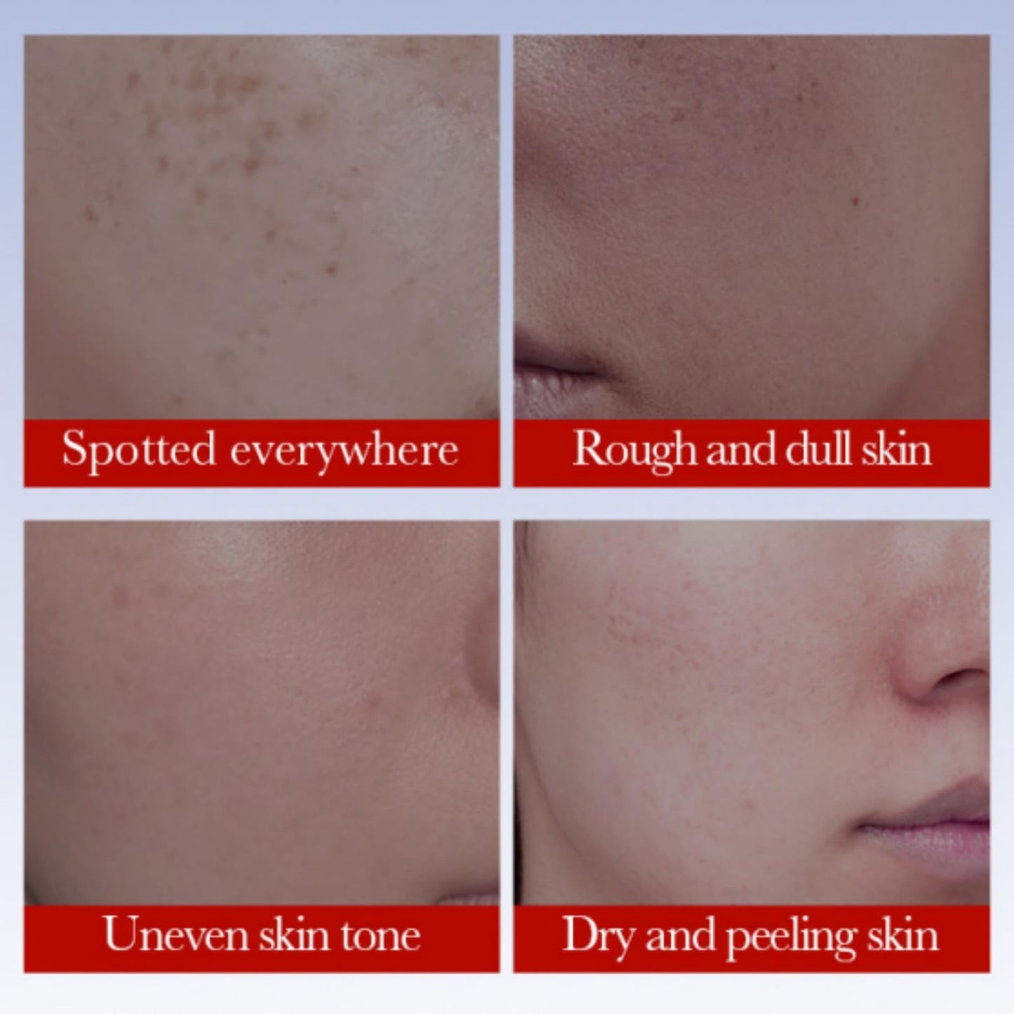 Ruojiar Freckle Removal Cream,Dark Spot Remover for Face and Body,Dark Spot Corrector Freckle Remover,Skin Brightening Cream,Moisturizing Anti-blemish Cre/am,Da/rk Spot Correcting Glow Serum,Spot Cre/am