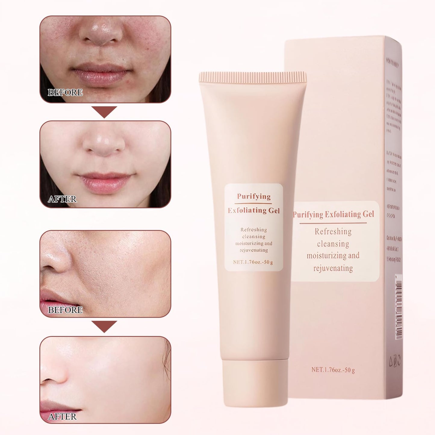 MADGININE 2-Pack Purifying Exfoliating Gel Purifying Cream 50g/Bottle Purifying Cream Purifying Exfoliating Gel Moisturizes the Skin Gentle Cleansing Unisex Suitable for Facial and Body Exfoliation