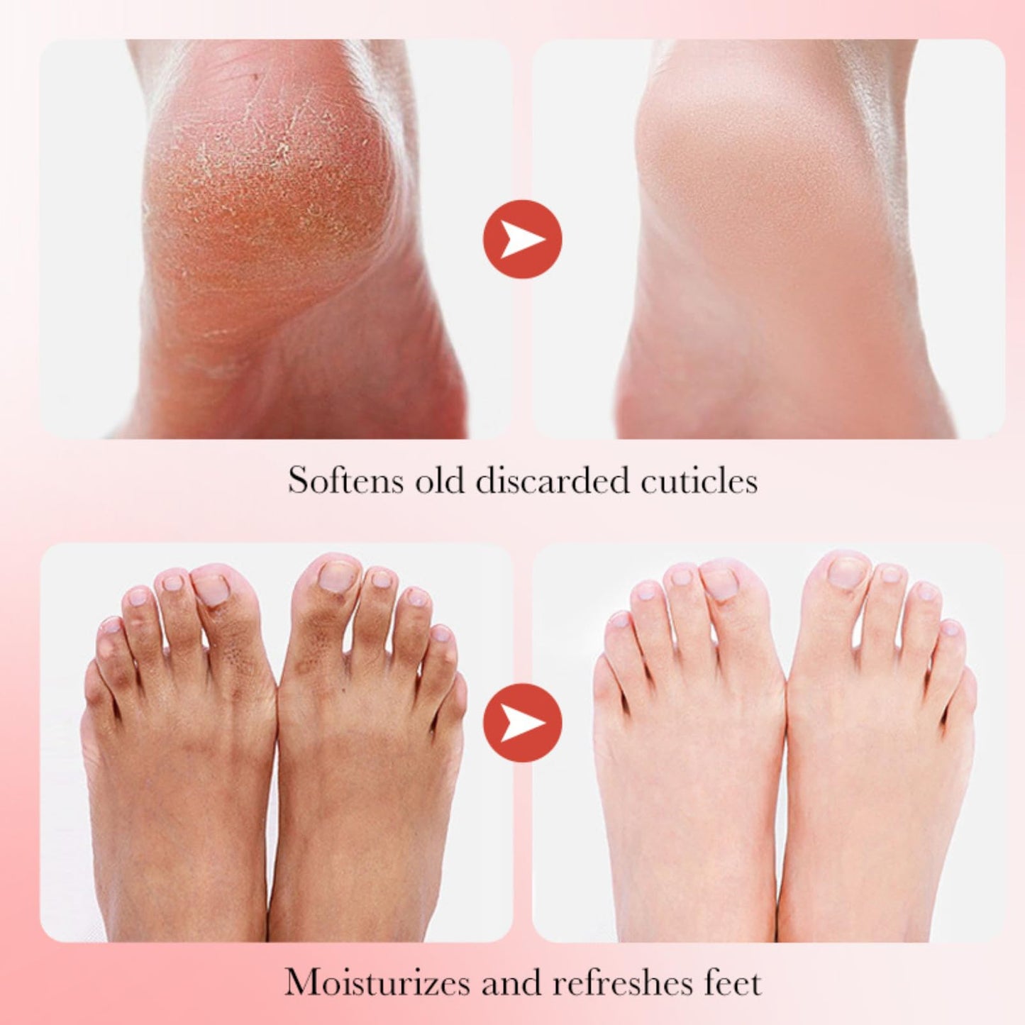 Foot Peel Mask - Foot Mask - Foot Peel Mask for Hard Skin - Foot Moisturiser Socks - Foot Exfoliator - Repair Heels & Removes Dry Dead Skin for Soft Feet 3 Pack (Strawberry)