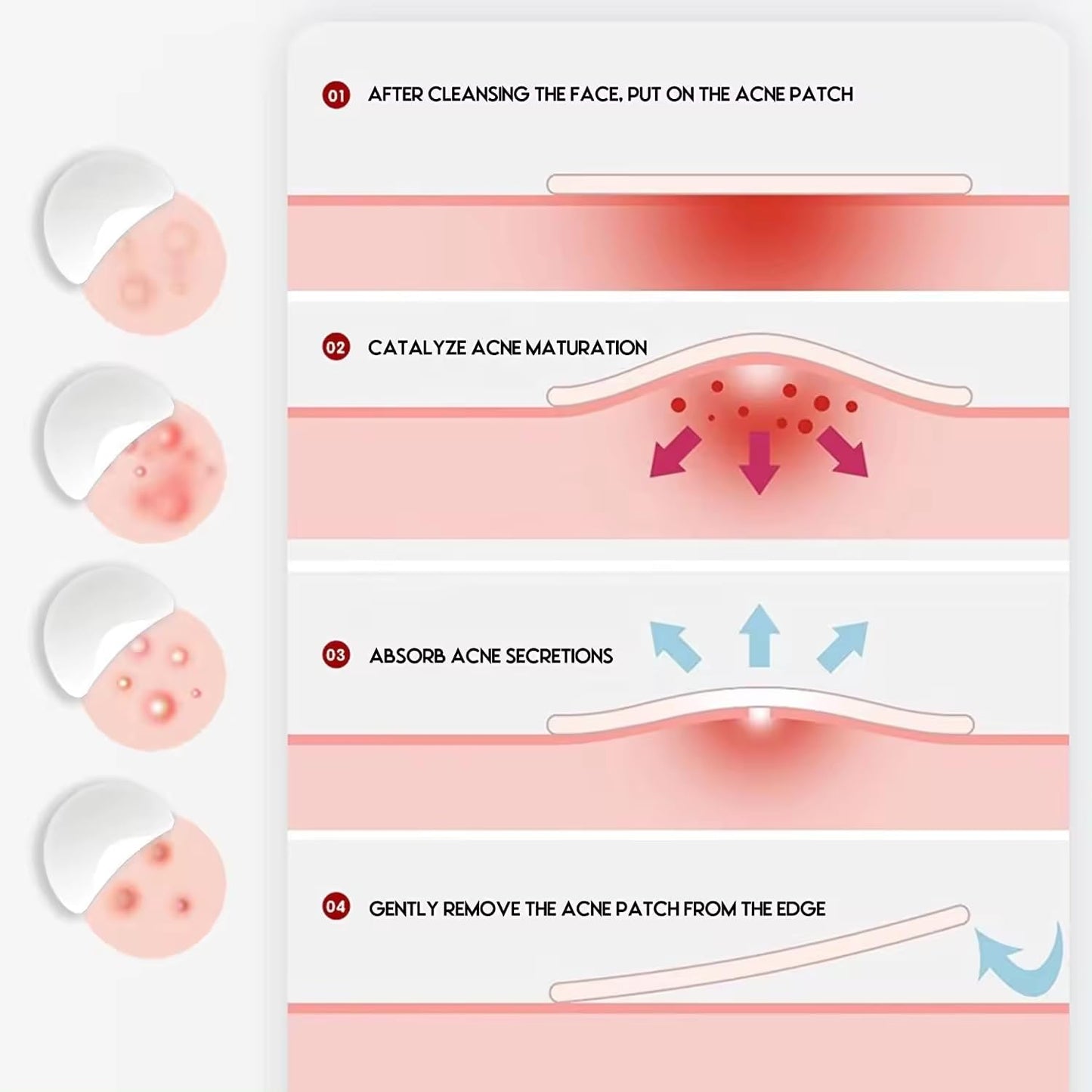 Pimple & Acne Patches, New Formula, Invisible Miracle Spot Cover - Hydrocolloid Acne Dressing Cover, Anti Acne Dots, Cruelty Free & Vegan, Pimple Stickers. (72)