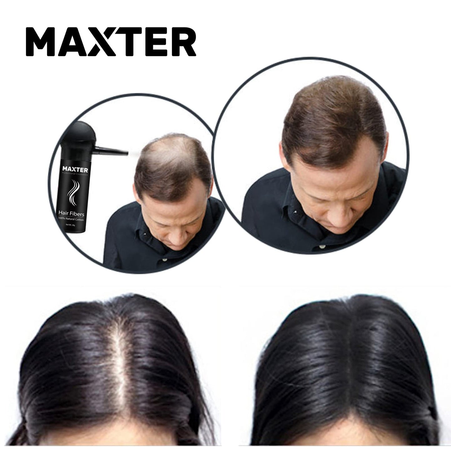 Maxter Bunee Hair Fibres - Hair Thickener - Hair Loss Coverage in 30 Seconds - 100% Natural Cotton Hair Powder Women and Men (Dark Brown 27.5g)