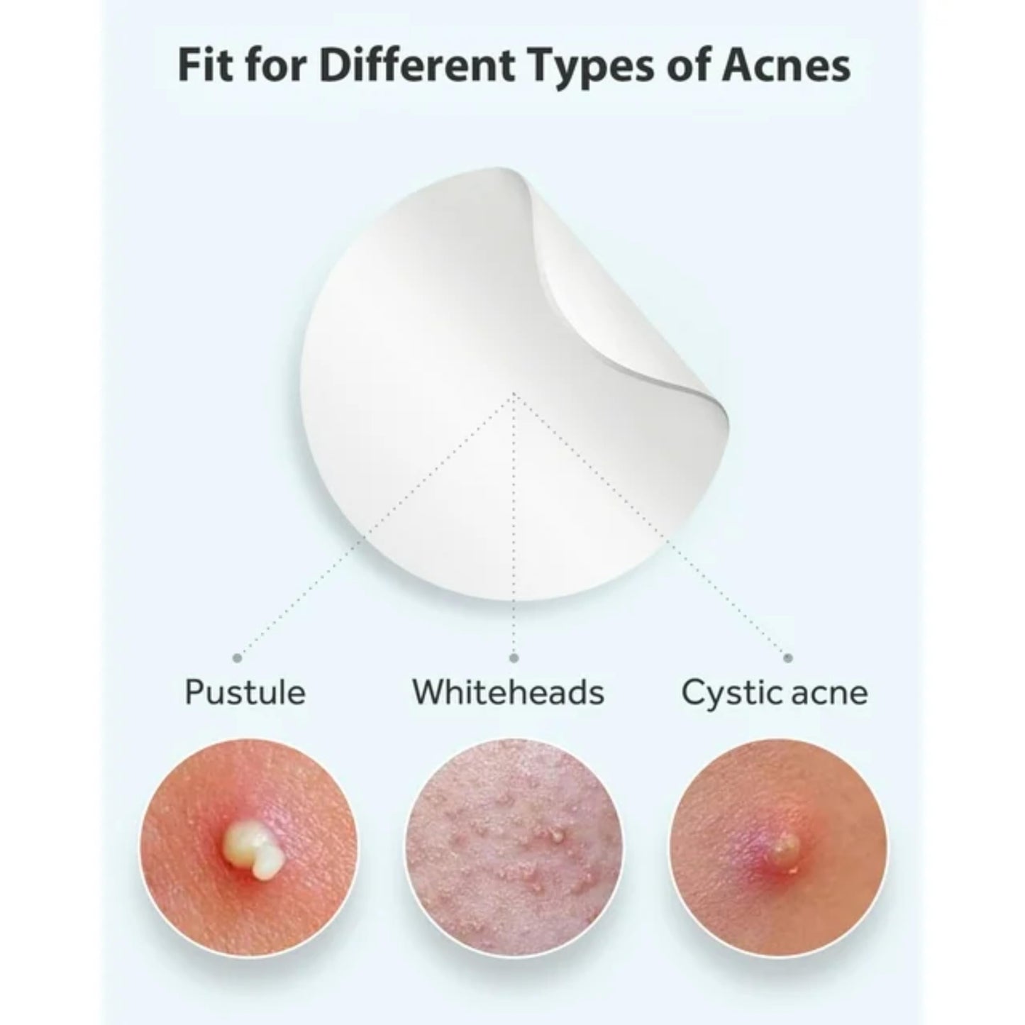 Generic Acne Patches - Pack of 24 Translucent Hydrocolloid Pimple Patch Spot Treatment Stickers for Face and Body - Fast-Acting, Vegan & Cruelty Free Skin Care
