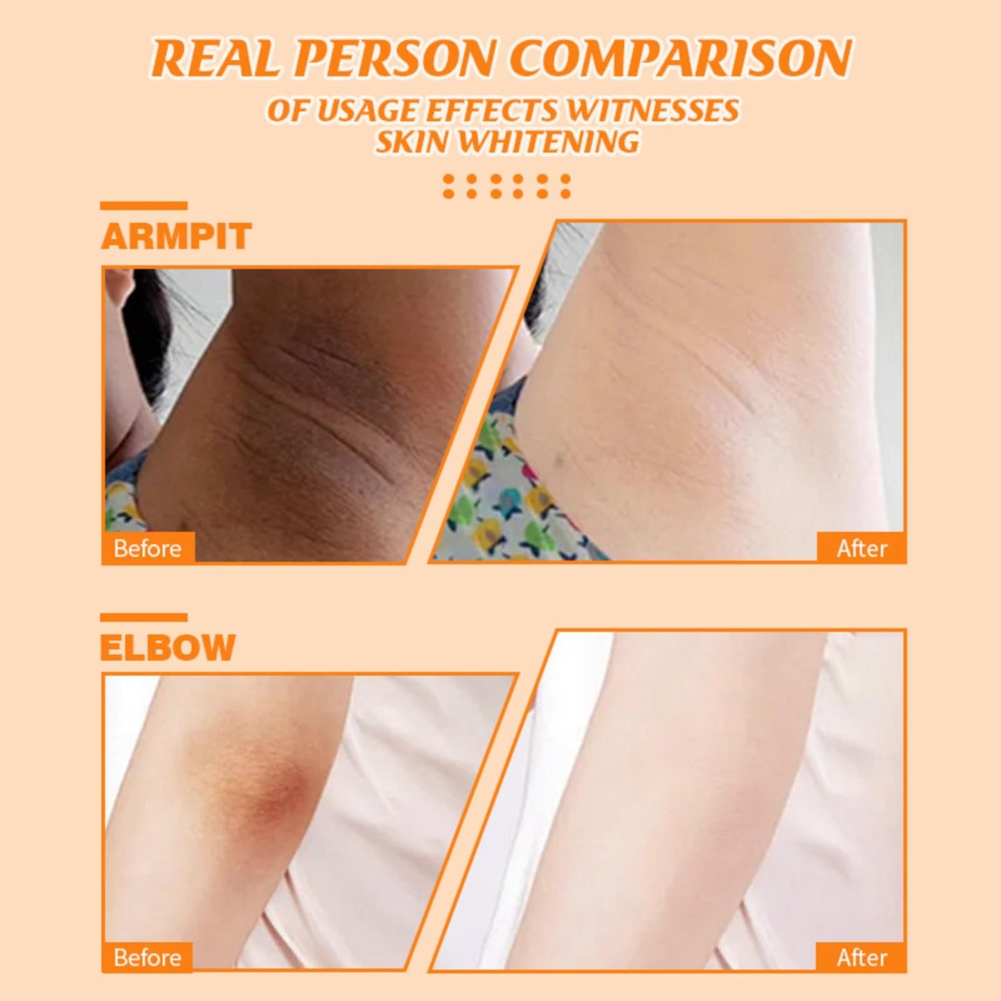 Kojic Acid Underarm Whitening Cream,Skin Bleaching Cream,Korean Skin Care for Armpits,Knees, Inner Thighs,Women Armpit Lightening Cream,Quickly Absorb & Reduce Odor,Smoothing,Whitening Lotion