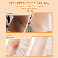 Kojic Acid Underarm Whitening Cream,Skin Bleaching Cream,Korean Skin Care for Armpits,Knees, Inner Thighs,Women Armpit Lightening Cream,Quickly Absorb & Reduce Odor,Smoothing,Whitening Lotion