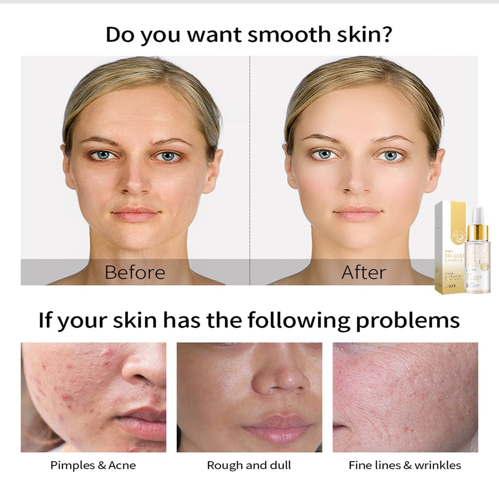 24K Mucin Snail Essence, Snail Mucin Serum Face Moisturiser with Hyaluronic Acid Serum, Niacinamide Serum, Ginseng Extract, Skincare for Hydrating, Anti-Wrinkle, Even Skin Tone