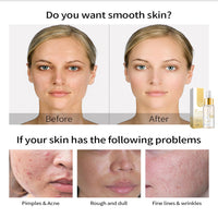 24K Mucin Snail Essence, Snail Mucin Serum Face Moisturiser with Hyaluronic Acid Serum, Niacinamide Serum, Ginseng Extract, Skincare for Hydrating, Anti-Wrinkle, Even Skin Tone