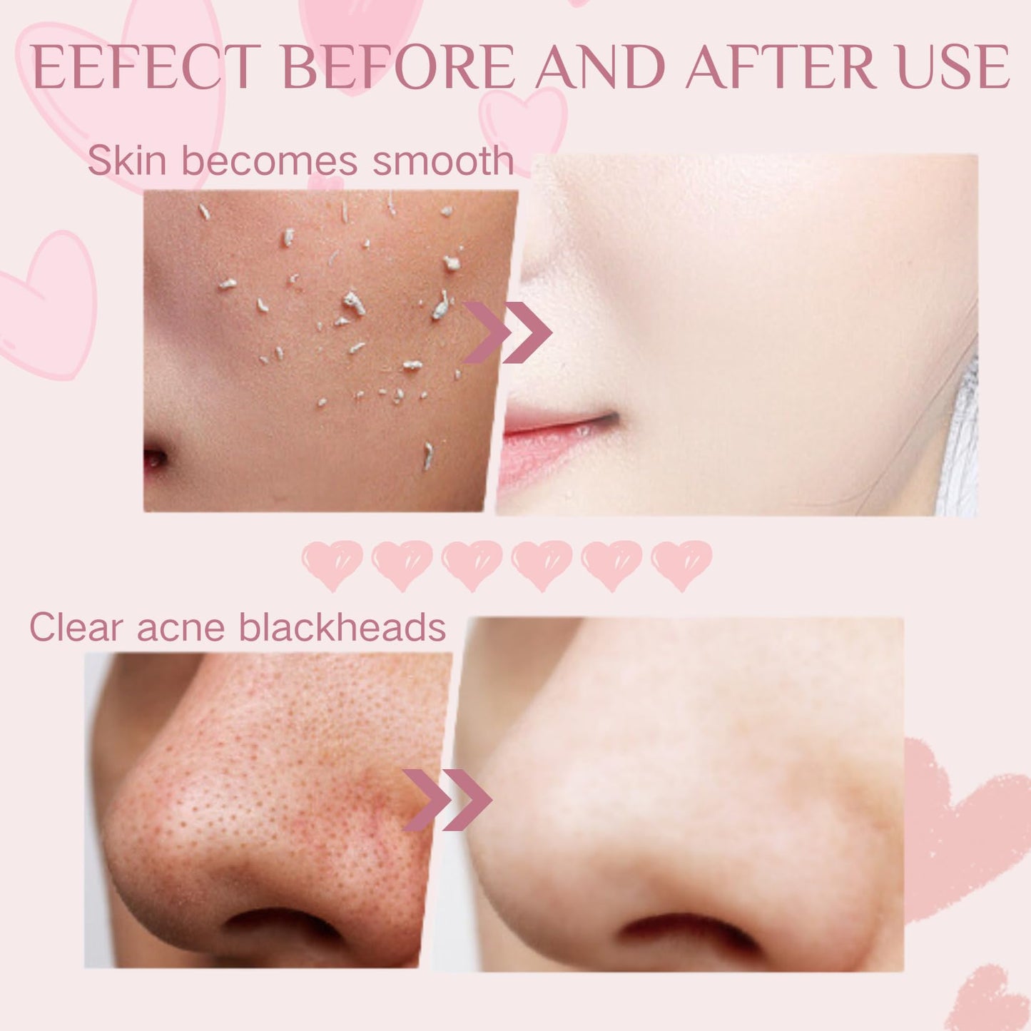 Purifying Exfoliating Gel - face scrub exfoliator - Facial Scrub - Exfoliating Gel for Face For Women - Face Skin Care Deep Cleansing Even Skin Tone Soft Skin 50g