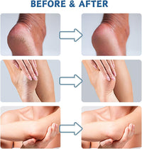 2PC Urea Cream 60 Percent for Feet, Cracked Heel Repair Cream Deeply Moisturizing with Aloe Vera, Urea Foot Cream for Cracked Heels and Dry Skin, Foot Moisturiser