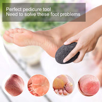Natural Pumice Stones for Feet, Premium Exfoliator & Foot File,Foot File Callus Remover Foot Cracked Heels,Dead Skin,Hard Skin (Black)