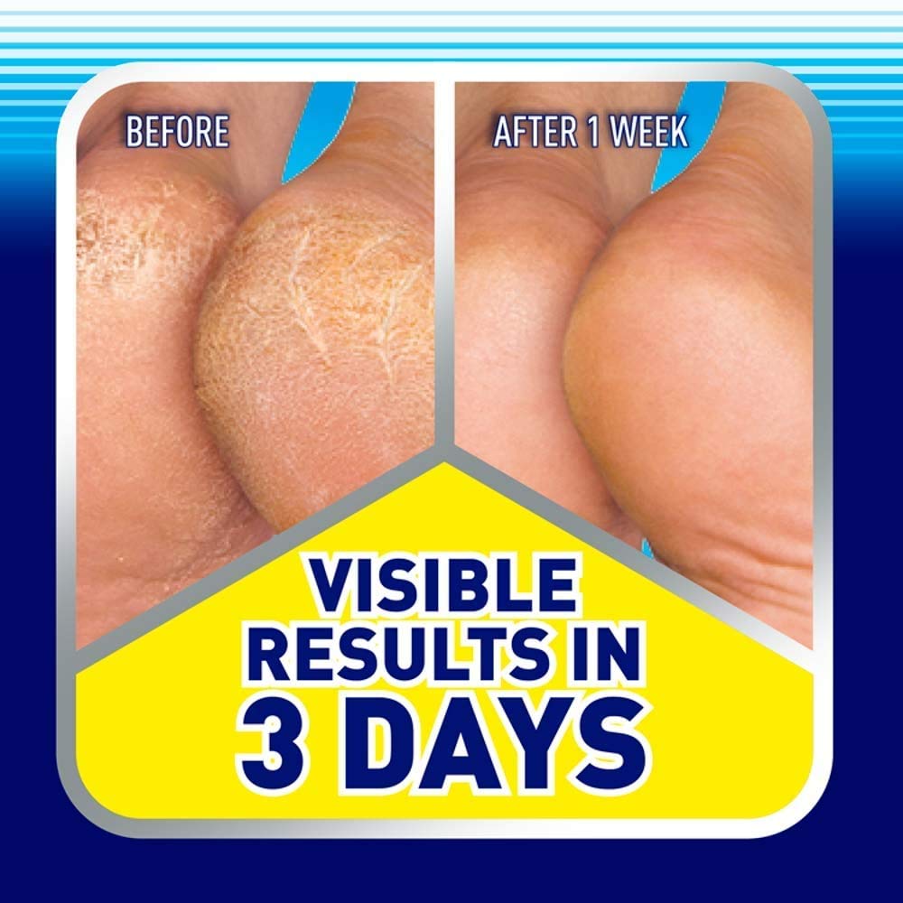 Scholl Cracked Heel Complete Cream with Repair K+, 60ml - Moisturising Treatment Cream for Cracked Heels and Dry Skin with Keratin (Pack Of 2)