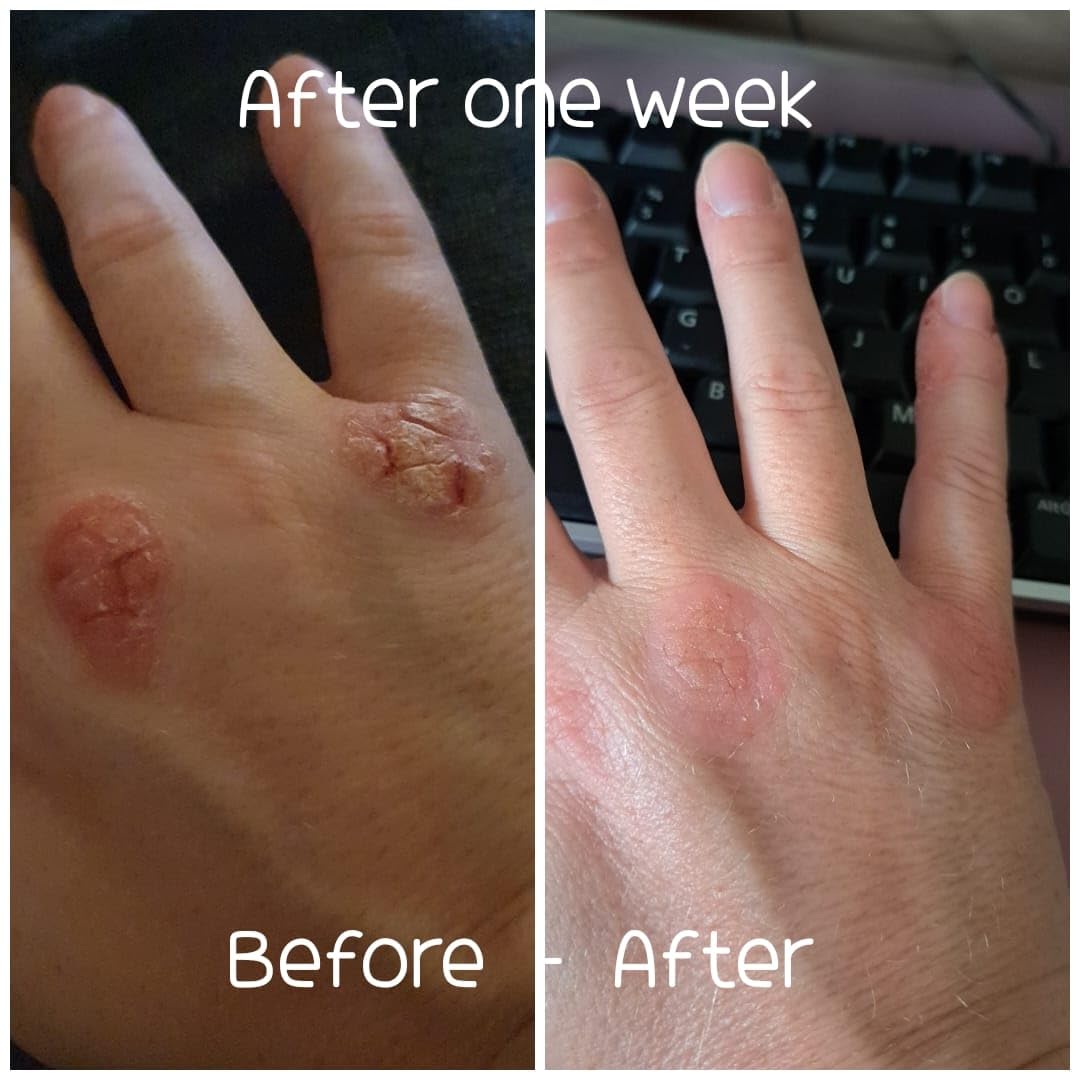 BUZZBALM Natural Propolis Cream Manuka Honey Cream Moisturiser Also Suitable (or Safe) For People Who May Be Prone to Problem Dry Skin Cream Cracked Hands (30g)