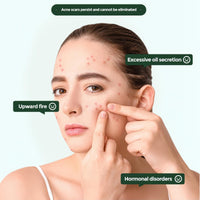 LaluluTek Face Pads - Exfoliator for Acne Prone Skin - Toner & Korean Skincare - Reduces The Growth Of Blackheads(55 pads)