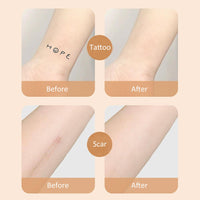 SHEBEEDO 10 PcsTattoo Cover Up Patch,High Coverage Ultra-Thin Skin Tattoo Cover Up Patch For Tattoos Scars Birthmarks Dark Spots, Long-Lasting Wear Waterproof,Seamless Makeup Stickers For Flawless Coverage