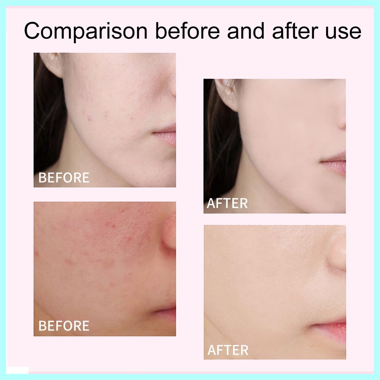 Xunzhi All Over Complexion Perfecter,Concealing Foundation Perfecting Cream,Perfect Cream Skin Tint,CC C/ream Foundation,Body Coverage Perfecter,Waterproof Corrector F/oundation,Body Makeup
