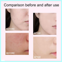 Xunzhi All Over Complexion Perfecter,Concealing Foundation Perfecting Cream,Perfect Cream Skin Tint,CC C/ream Foundation,Body Coverage Perfecter,Waterproof Corrector F/oundation,Body Makeup