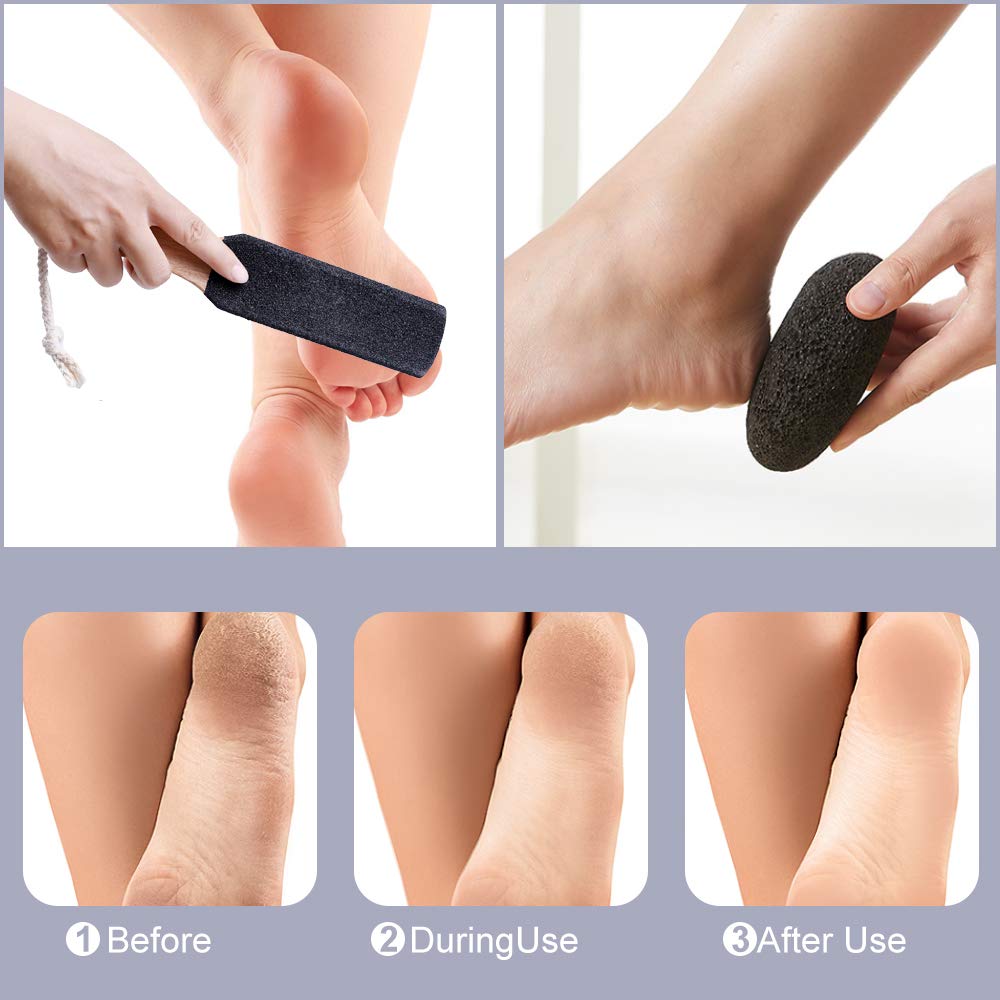 Natural Pumice Stones for Feet, Premium Exfoliator & Foot File,Foot File Callus Remover Foot Cracked Heels,Dead Skin,Hard Skin (Black)
